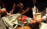 چرخ‌گوشت مچ دست کودک اصفهانی را قطع کرد